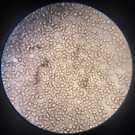 laboratorio2bach: Observación al microscopio de células sanguíneas (sin ...