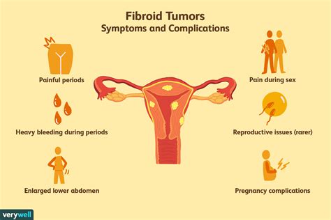 [31+] Uterine Fibroids Signs And Symptoms