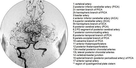 Pin on Neuroscience Nursing