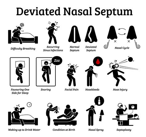 Ct Scan Deviated Septum Purchase Discounts | clc.cet.edu