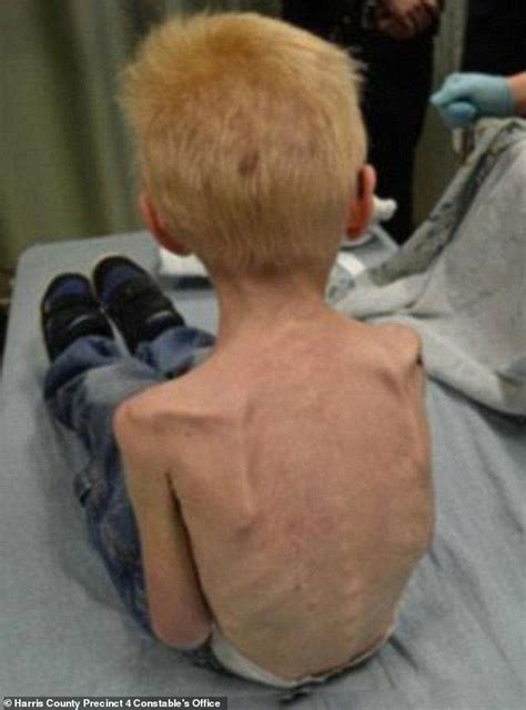 Siblings of five-year-old who was starved revealed how they saved him | Daily Mail Online