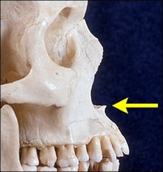 Anterior nasal spine - Definition, Anatomy and Pictures - Bodterms