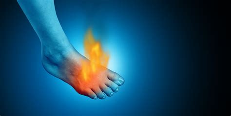 Idiopathic Peripheral Neuropathy and Chiropractic | The American ...