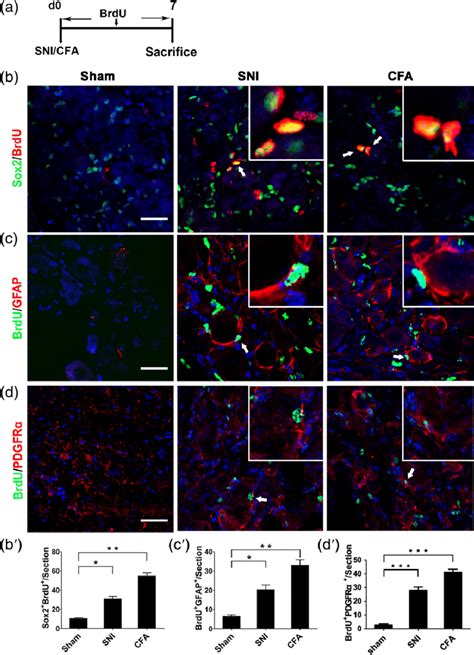 Proliferation of DRG satellite glial cells following chronic pain. (a ...