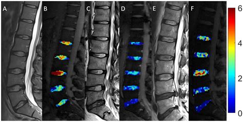 Diagnostics | Free Full-Text | Non-Specific Low Back Pain and Lumbar Radiculopathy: Comparison ...