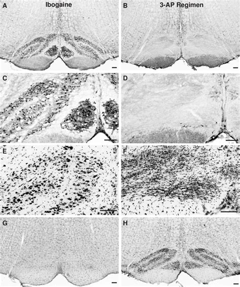 Most neurons in the inferior olivary nucleus degenerate after ...