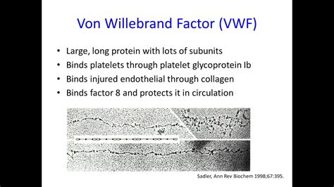 2020 Science Update on the Diagnosis of Von Willebrand Disease - YouTube