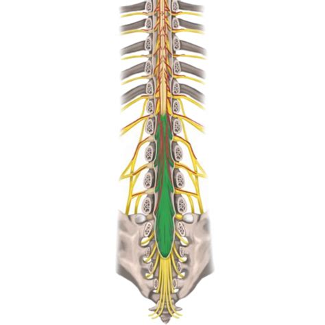 Enlarged Cauda Equina Nerve Roots In Cerebrotendinous Xanthomatosis ...