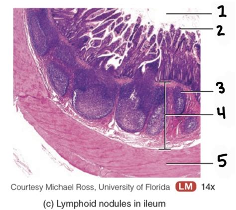 Histology of Ileum Flashcards | Quizlet