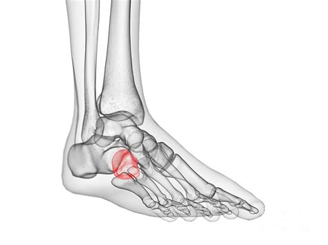 Cuboid Bone Photograph by Sebastian Kaulitzki/science Photo Library ...