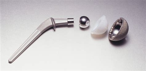 Biomet Hip Replacement Attorneys | AIAG