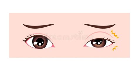 Myokymia Stock Illustrations – 3 Myokymia Stock Illustrations, Vectors & Clipart - Dreamstime