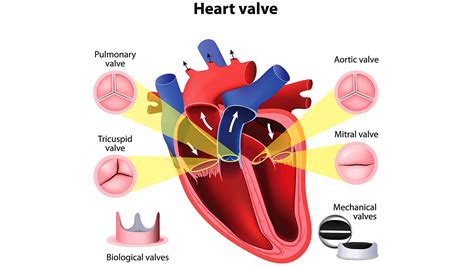 Mechanical Heart Valve Noise May Mean Sleepless Nights | Everyday Health