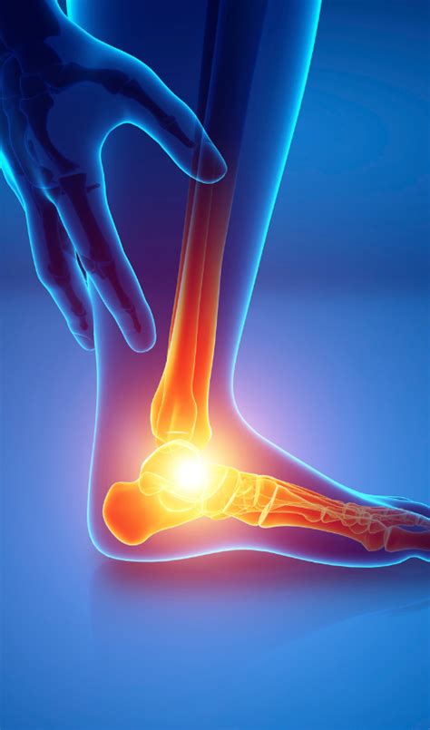 Causes and Treatments for Lateral Foot Pain – Bilt Labs