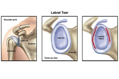 Wander Javier's Labral Tear - Articles - Articles - Articles - Twins Daily