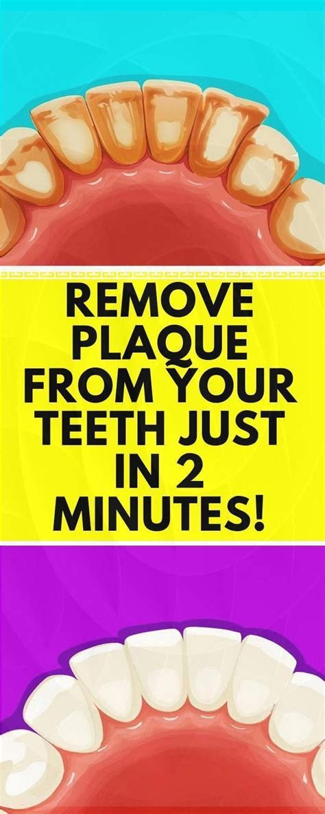 Incredible How To Reduce Tooth Plaque 2022