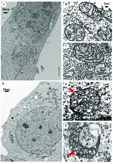 Mitochondrial morphology of HAP1WT cells and HAP1∆TAZ cells. HAP1 WT... | Download Scientific ...