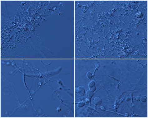 Fungal Biodiversity: Zygomycetes Associated with Plant Roots