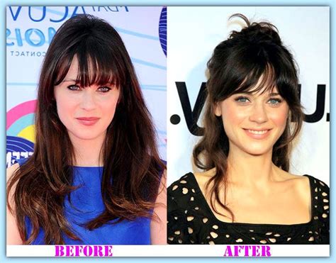 Zooey Deschanel plastic surgery, rumor or not? | Celebrity plastic ...