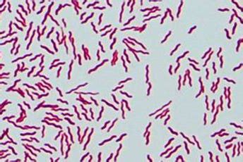 Bacteria Names: Name and Gram Stain at Loma Linda Academy - StudyBlue