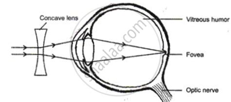 Given Alongside is a Diagram Depicting a Defect of the Human Eye. Study the Same and Then Answer ...