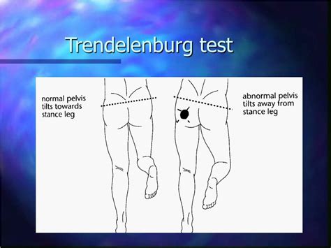 PPT - Easy assessment of musculoskeletal system for GPs PowerPoint ...