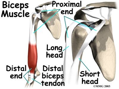 What is a Biceps Tendon Rupture and How is it Fixed? - Beacon Orthopaedics