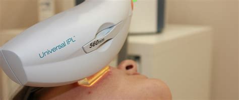 ACNE AND ROSACEA TREATMENT WITH INTENSE PULSED LIGHT – IPL LUMENIS M22 ...