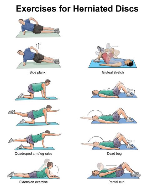 Herniated Disc in Neck Exercises - Pain Neck