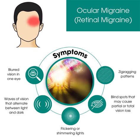 Ocular Migraine Treatment NYC | Retinal Migraine Specialists in Downtown Manhattan