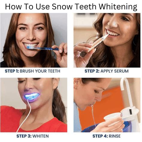 Snow Teeth Whitening Before And After Photos & Videos - Drug Genius