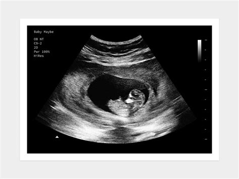 8 Weeks "Little Bean" | Fake Ultrasound w/ Instant Download!