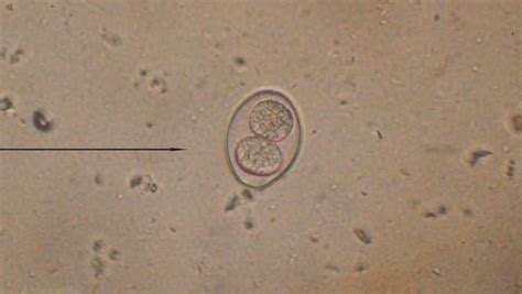 Toxoplasma gondii Footage | Stock Clips