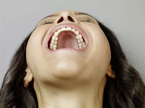 Lingual Braces: The “Hidden” Braces Adults Are Thrilled About - Your Dental Health Resource