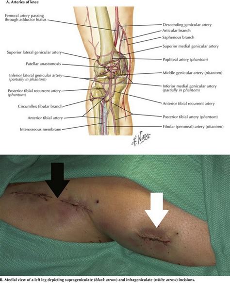 Popliteal Vein