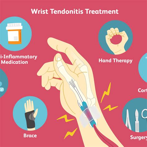 How To Diagnose Tendonitis - Gameclass18