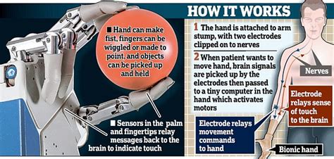 The world's first bionic hand that will allow patients to 'feel' sensations set to be ...