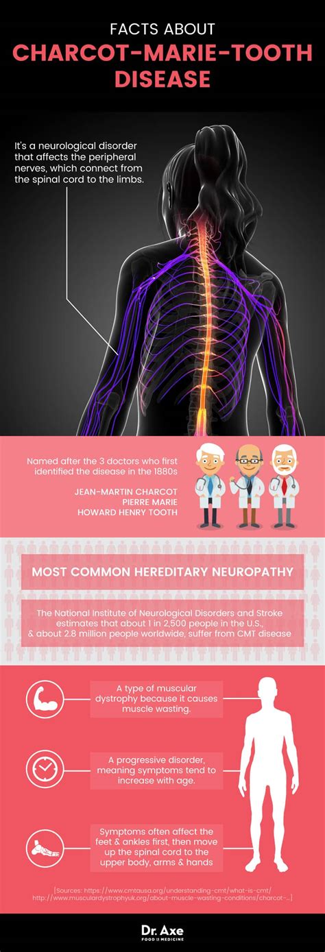 Charcot-Marie-Tooth Disease +5 Ways to Manage Symptoms - Dr. Axe