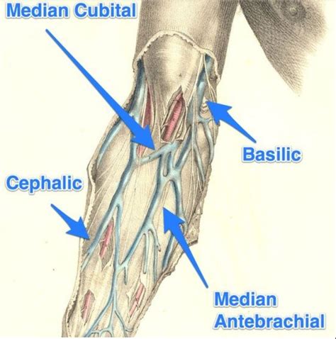 #Phlebotomy class in session! Can you name these parts of the arm on a ...