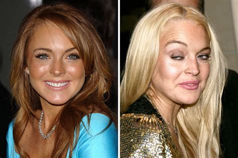 Horrible: 18 Shocking Photos Of Famous Celebrities Before And After ...