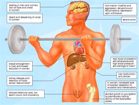 Side Effects Of Anabolic Steroids – Medchrome