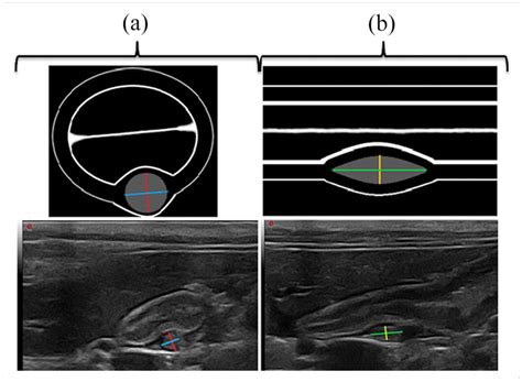 Ultrasound appearance of the duodenal papilla in clinically healthy cats - Charlotte Coeuriot ...