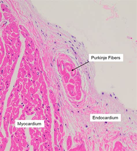 Visceral Pericardium Histology