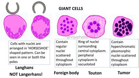 GRANULOMATOUS INFLAMMATION - Pathology Made Simple