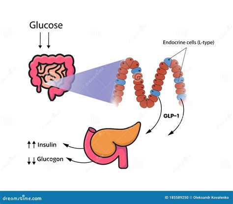 GLP-1 Release by the Cells of the Small Intestine and Colon. L-cells Produce Glucagon-like ...