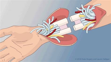 Vascularized Composite Allograft Laboratory | Duke Department of Surgery