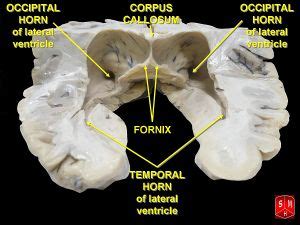 Ventricular system - CreationWiki, the encyclopedia of creation science