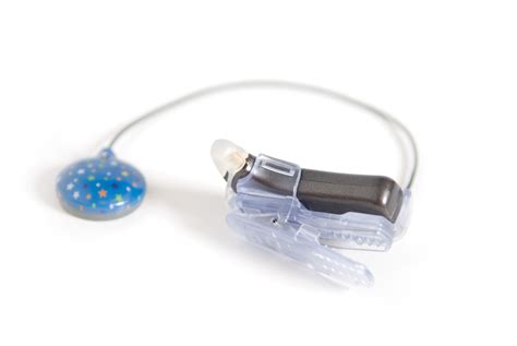 Advanced Bionics KinderClip #cochlearimplant | Cochlear implant