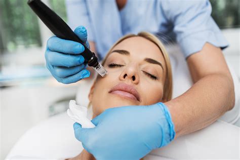 Microneedling w/ PRP - Dermatology Specialists of Spokane