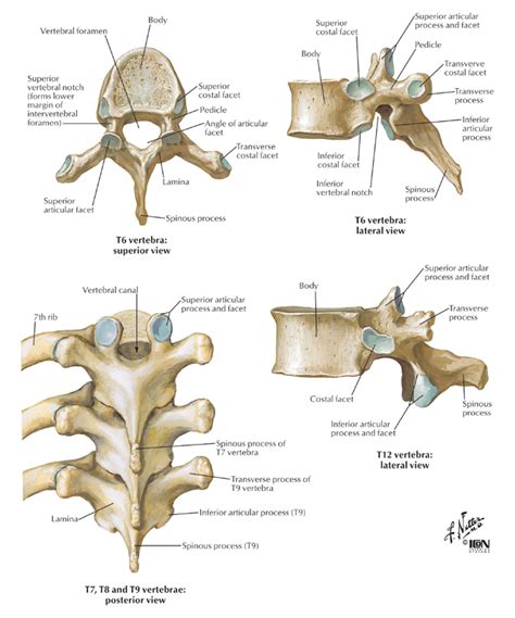 Spine & Back:Bones:Thoracic vertebrae | RANZCRPart1 Wiki | Fandom powered by Wikia